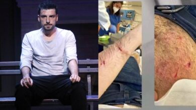 Στο νοσοκομείο ο ηθοποιός Σπύρος Χατζηαγγελάκης μετά από επίθεση που δέχτηκε από σκύλο