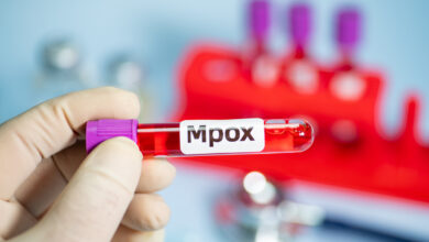 Νόσος mpox: 647 κρούσματα το τελευταίο 3μηνο στην Ευρώπη