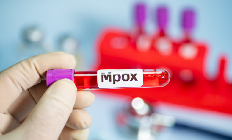 Νόσος mpox: 647 κρούσματα το τελευταίο 3μηνο στην Ευρώπη