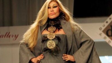 Jocelyne Wildenstein: Η «γυναίκα γάτα» λέει ότι δεν έχει κάνει ποτέ πλαστικές – «Μισώ τα botox»