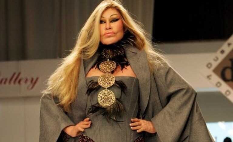 Jocelyne Wildenstein: Η «γυναίκα γάτα» λέει ότι δεν έχει κάνει ποτέ πλαστικές – «Μισώ τα botox»