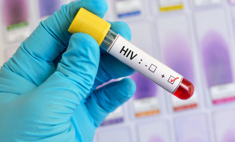 HIV: 550 νέα περιστατικά λοίμωξης το 2024 στην Ελλάδα