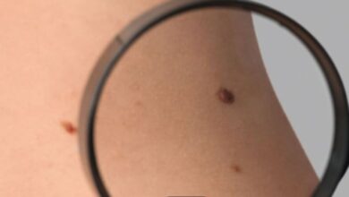 Το εξατομικευμένο εμβόλιο mRNA που αλλάζει τα δεδομένα στο μελάνωμα