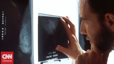 Νέα έρευνα: Το AI μπορεί να προβλέψει σοβαρές καρδιακές παθήσεις στις μαστογραφίες