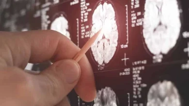 Οι οικονομικές δυσκολίες επιταχύνουν τη γνωστική έκπτωση