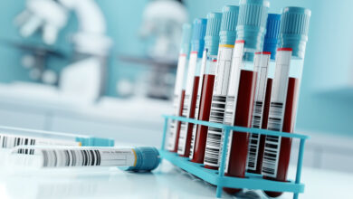 Απλή εξέταση μπορεί να εντοπίζει νωρίς έναν από τους πιο δύσκολους καρκίνους
