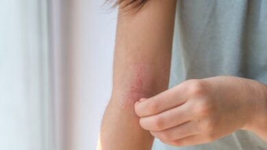 Όταν το καλοκαίρι παύει να είναι περίοδος ύφεσης