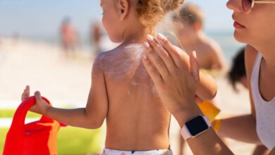 Ηλιακά εγκαύματα στα παιδιά: Έως τριπλάσιες πιθανότητες καρκίνου του δέρματος στο μέλλον