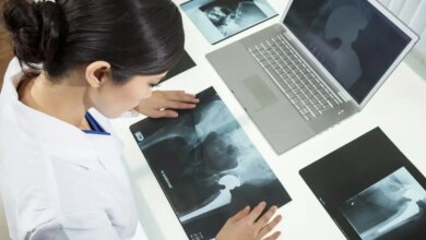 Νέα τεχνική αρθροπλαστικής ισχίου εφαρμόζεται για πρώτη φορά στην Ελλάδα