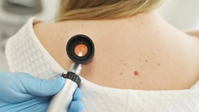 Μελάνωμα: Ελπίδες από νέο εμβόλιο mRNA – Μελετάται η χρήση του και σε άλλους καρκίνους