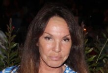 Η Βάνα Μπάρμπα για την αισθητική επέμβαση στα 22 της: Κάναμε λάθη μέσα σε αυτή την αγωνία της ομορφιάς