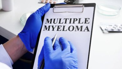 Ασθενής ζει 8 χρόνια με επιθετικό καρκίνο στο αίμα, χάρη σε πρωτοποριακή θεραπεία