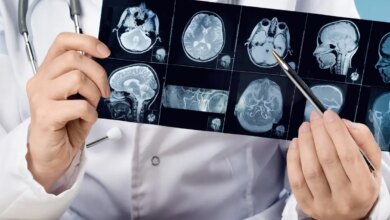 Αυξάνονται τα εγκεφαλικά επεισόδια στους νέους