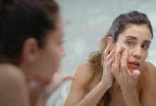 Έχετε ακμή; Η διατροφή σας μπορεί να ευθύνεται γι’ αυτήν, σύμφωνα με νέα μελέτη