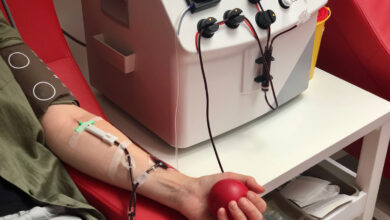 Πλασμαφαίρεση: Τι είναι και πότε εφαρμόζεται, σύμφωνα με γιατρούς του ΕΚΠΑ