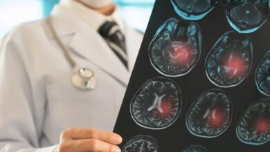 Η πρόωρη γέννηση διακόπτει την ωρίμανση του εγκεφάλου, διαπιστώνει έρευνα με επικεφαλής Έλληνες επιστήμονες