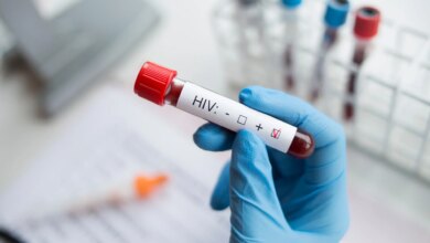AIDS: Οι επιστήμονες μαθαίνουν να ελέγχουν τον HIV χωρίς φάρμακα AIDS: Οι επιστήμονες μαθαίνουν να ελέγχουν τον HIV χωρίς φάρμακα