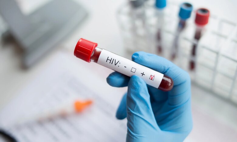 AIDS: Οι επιστήμονες μαθαίνουν να ελέγχουν τον HIV χωρίς φάρμακα