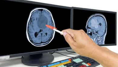 Γλοιοβλάστωμα: Βιταμίνη Β3 μαζί με τη συνήθη θεραπεία
