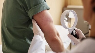 ΕΔΑΕ: Τα αυτοάνοσα φλεγμονώδη δερματικά νοσήματα δεν είναι μεταδοτικά
