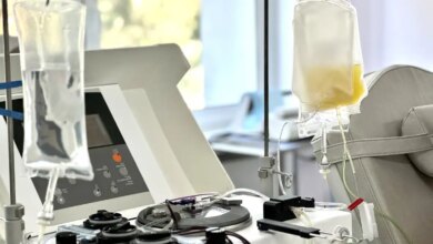 Πλασμαφαίρεση: Σε ποιες περιπτώσεις έχει αποδεδειγμένα οφέλη και γιατί δεν είναι θεραπεία ευεξίας