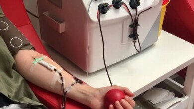 Η πλασμαφαίρεση είναι ασφαλής στα σωστά χέρια και δεν έχει σχέση με «θεραπείες ευεξίας»