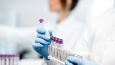 Φερριτίνη: Υψηλότερα όρια στις νέες οδηγίες για πιο έγκαιρη διάγνωση της έλλειψης σιδήρου